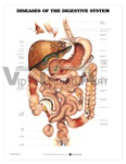 Diseases of the Digestive System Anatomical Chart